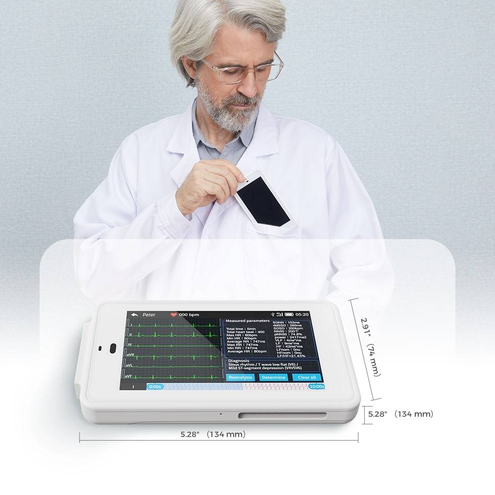 Portable 12Lead ECG Machine with Interpretation Fits into Your Pocket